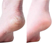 Balea- Urea Feet Cream كريم للعناية بالقدمين باليوريا بالي, حمل الصورة الى البوم الصور