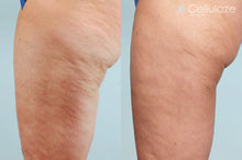 Load image into Gallery viewer, Isana- Anti Cellulite Cream Gel كريم إيسانا ضد السليولايت ولشد الجلد

